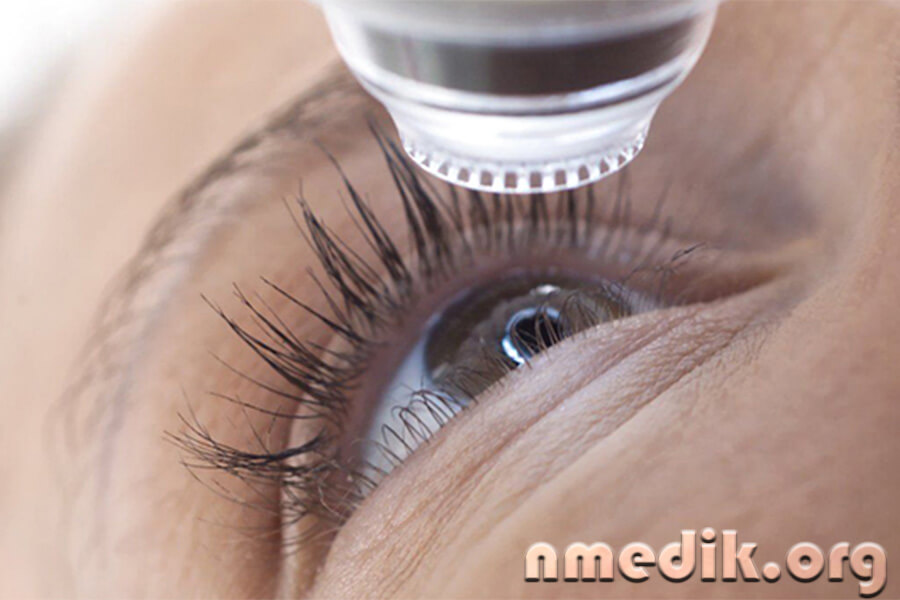 Ангиопатия сетчатки глаза Ангиопатия сетчатки глаза