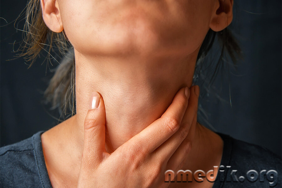 Гипотиреоз Гипотиреоз