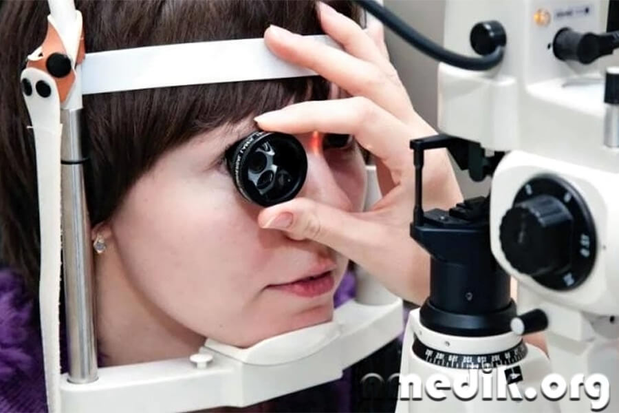 Кератит Кератит