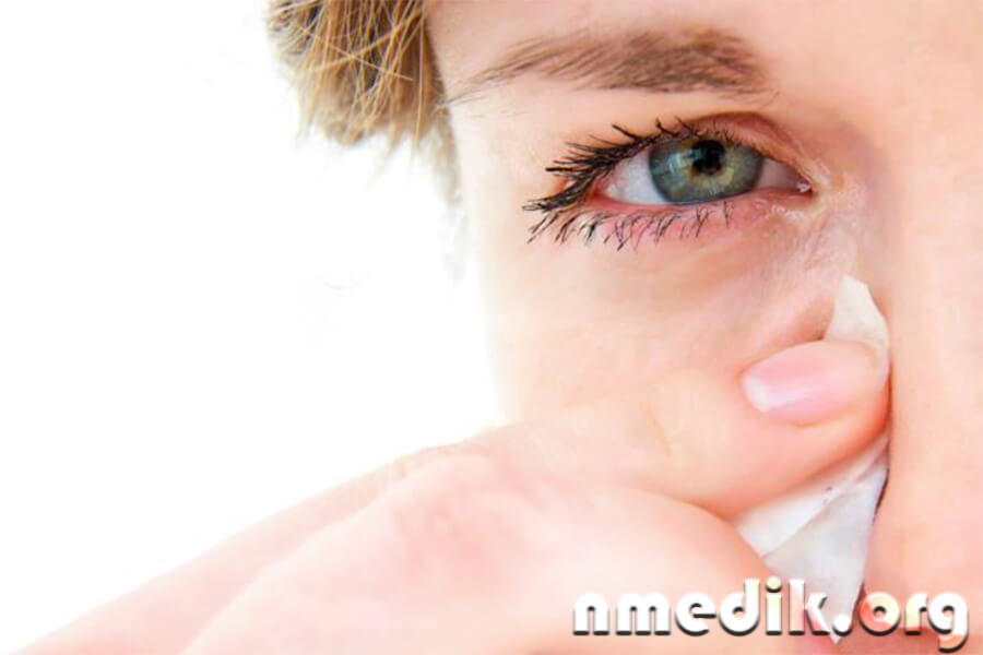 Увеит Увеит